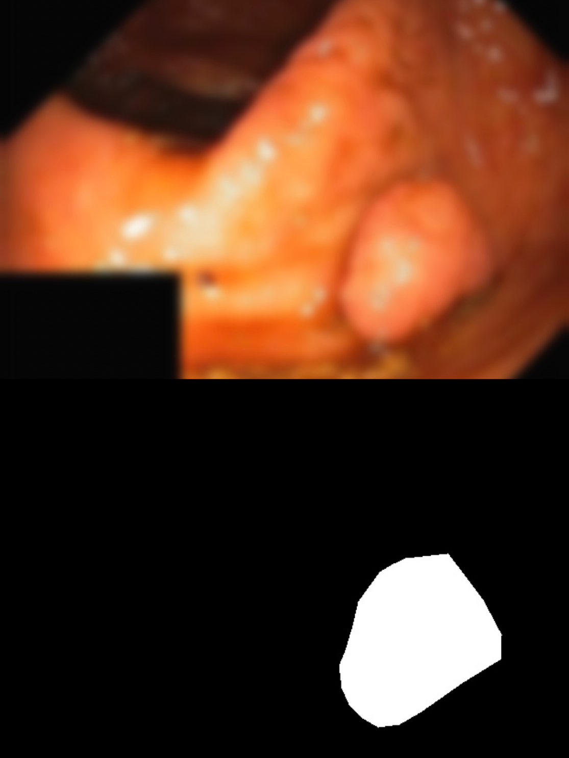 Softened Kvasir-SEG endoscopic polyp image and corresponding ground-truth mask